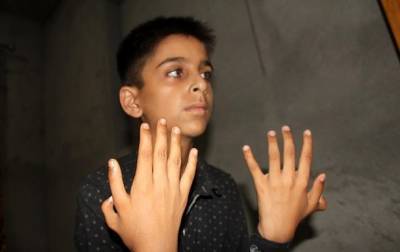 Мальчику из Индии лишние пальцы помогают достигать успехов