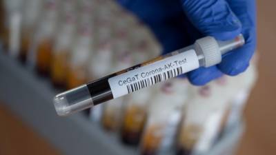 Немецкие клиники навязывают пациентам бесполезные тесты на антитела к Covid-19
