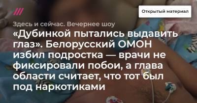 «Дубинкой пытались выдавить глаз». Белорусский ОМОН избил подростка — врачи не фиксировали побои, а глава области считает, что тот был под наркотиками. Интервью с адвокатом пострадавшего Тимура