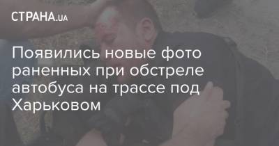 Появились новые фото раненных при обстреле автобуса на трассе под Харьковом