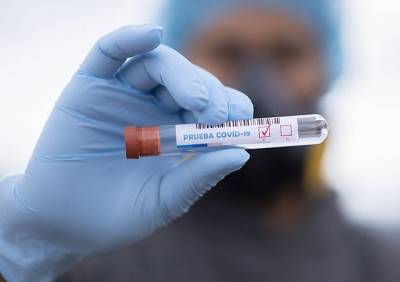 За сутки более 30 рязанцев заболели коронавирусом