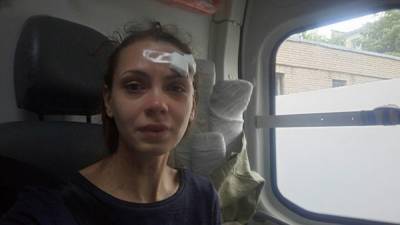В Петербурге на избитую в избиркоме активистку составили протокол о побоях