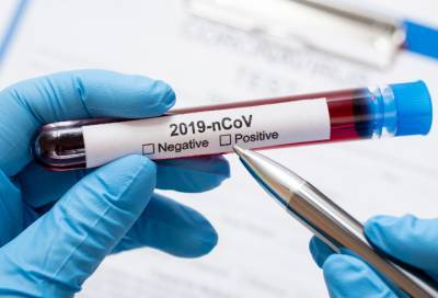 За последние сутки в России выявили 4941 новый случай коронавируса