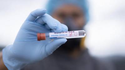 По России выявили еще 4941 случай заражения коронавирусом