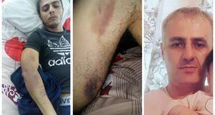 Источники сообщили о жестоком избиении еще двух задержанных в Южной Осетии