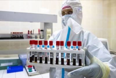 РФПИ: За 10 дней в России зарегистрируют первую в мире вакцину от Covid