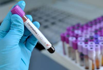 За последние сутки коронавирус нашли у 32 жителей Ленобласти