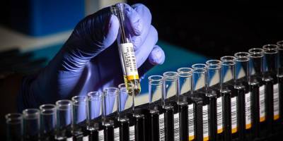 Лаборанты грозят: «Не будем публиковать результаты тестов на коронавирус»