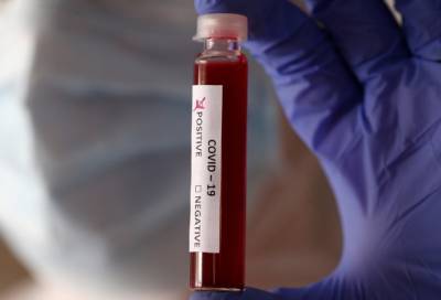 Новые 32 случая коронавируса выявили в 10 районах Ленобласти