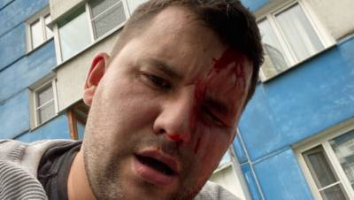 В Петербурге избили борца с незаконной торговлей