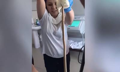 Змея заползла в рот к спавшей россиянке: рептилию достали врачи (18+)