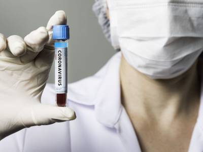 Количество инфицированных коронавирусом в Украине превысило 120 тыс.