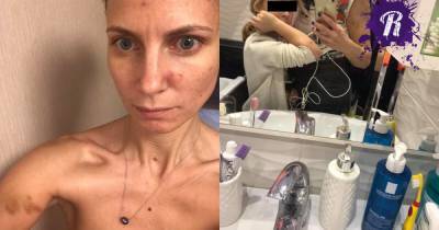 Жертву домашнего насилия оштрафовали за то, что она рассказала о побоях в соцсетях - readovka.news - Москва