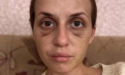 «Сын просит прощения, что не защитил»: жестоко избитая в поезде украинская телеведущая так и не восстановилась, а ее 6-летнему ребенку нужен психолог