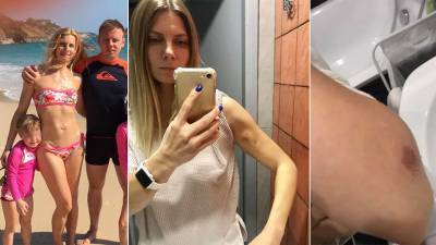 Суд оштрафовал москвичку, рассказавшую в соцсети об избиении мужем