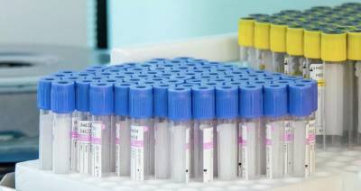 Более 6,5 млн тестов на коронавирус провели в Москве
