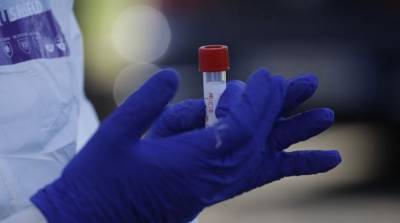 В Украине вновь за сутки выявили более тысячи случаев коронавируса