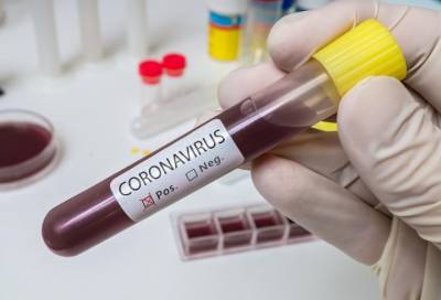 Новые случаи коронавируса нашли в 9 районах Ленобласти