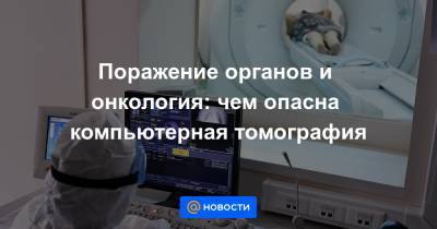 Поражение органов и онкология: чем опасна компьютерная томография - news.mail.ru