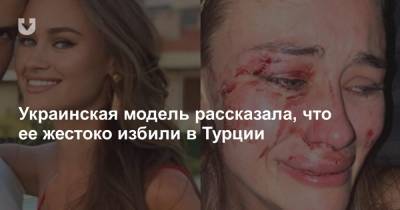 Украинская модель рассказала, что ее жестоко избили в Турции