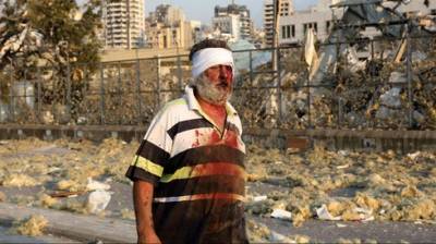 Тысячи пострадавших от взрыва в Бейруте: Израиль предложил Ливану помощь