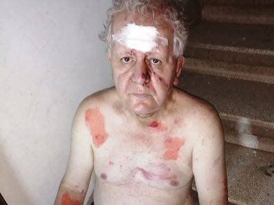 В Бейруте ранен журналист Амо Москофян