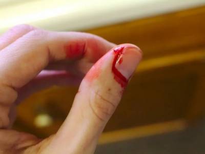 В Москве девушка откусила насильнику палец и вызвала ему «скорую»