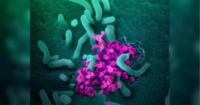 Каждые 15 секунд в мире умирает больной коронавирусом, — Reuters