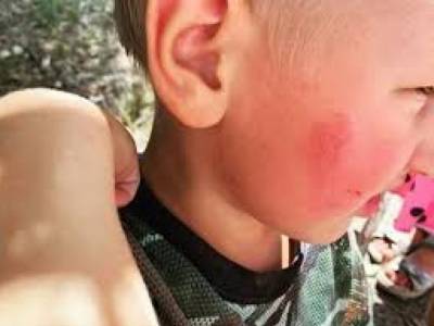 В Днепропетровской области многодетная мать на глазах людей ударила 2-летнего сына об асфальт