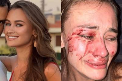 Нападение на украинскую модель в Турции: девушка рассказала, как пыталась защитить своего парня