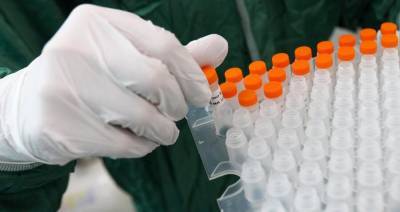 Более 30,3 млн тестов на коронавирус провели в России