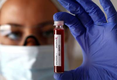В Ленобласти зафиксирован 31 новый случай коронавируса