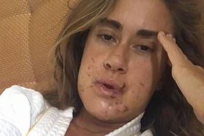 Дочь Успенской показала свое лицо после тяжелой травмы