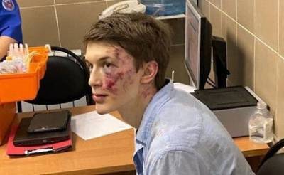 «Первый удар пришелся в затылок»: в Москве сильно избили российского оппозиционера