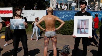 ООН сообщило о сотнях случаев пыток в Белоруссии