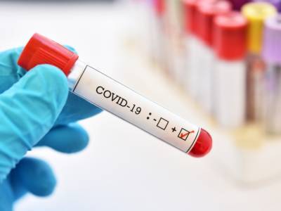 За сутки в Украине зафиксировано еще 2 тысячи 582 случая заболевания коронавирусом