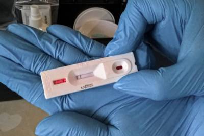Украина закупит у Израиля дешевые тесты, которые выявляют коронавирус за 10 секунд