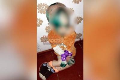 В Омской области возбудили дело по факту истязания полуторагодовалого мальчика