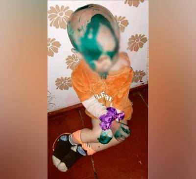 Мать, истязавшего ребенка в Омской области, могут ограничить в правах