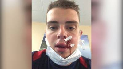 Видео нападения на хоккейного тренера выложили в сеть.
