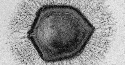 Гигантские вирусы помогли объяснить эволюцию клеточного ядра