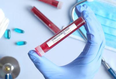 За сутки в Ленобласти выявили 36 новых случаев коронавируса