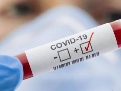 Количество умерших от коронавируса в мире приближается к миллиону человек