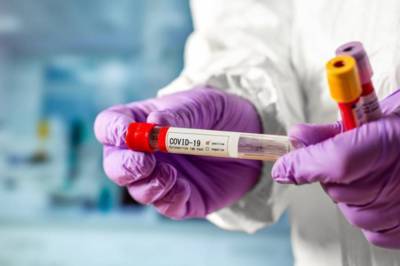 За минувшие сутки в Украине выявили 2462 новых случаев коронавируса