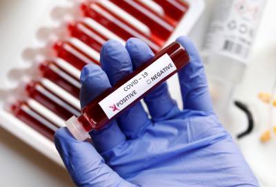 Новые 36 случаев коронавируса выявили в восьми районах Ленобласти