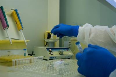 За сутки в Томской области выявили 52 случая заражения коронавирусной инфекцией