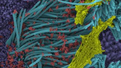 Учёные показали поразительные снимки клеток, заражённых SARS-CoV-2