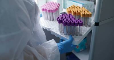 В России выявили 5 670 новых случаев коронавируса