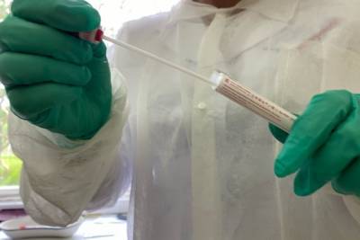 За сутки в Тверской области 25 человек заболели коронавирусом