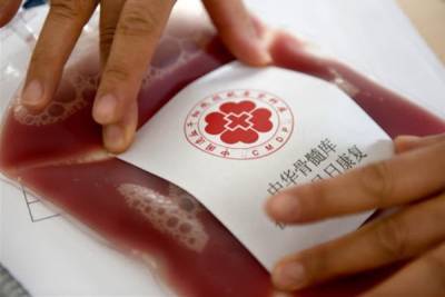 Число случаев донорства кроветворных стволовых клеток в КНР достигло 10 тысяч